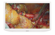 Sony LMD-X3200MD 32 inch 4K Ultra HD Surgical Monitor